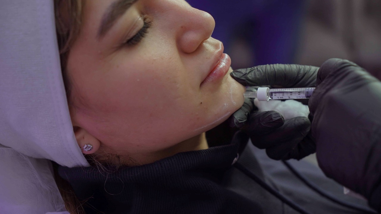 تزریق فیلر چونه